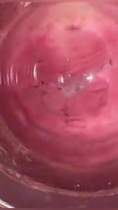 Camera in Vagina, Cervix POV, Creampie | Clip 1