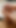 TEASER #10
