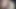 enlarged my wife's anus by 4cm, day 1