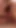 vs Tiny