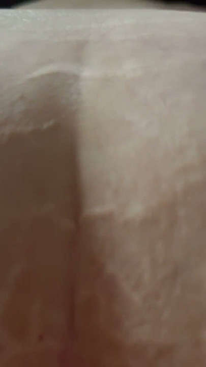 Bolesny suchy anal | Klip 1