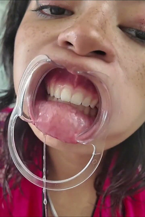 לחיים נמשכות הצידה שיניים חשופות