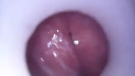 Internal cum