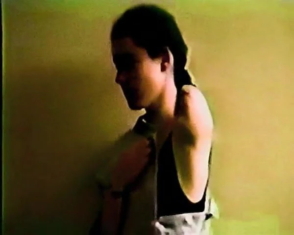 cute arm amputee
