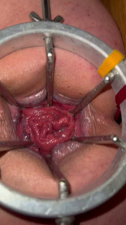 Anal expander fully open showing off rose