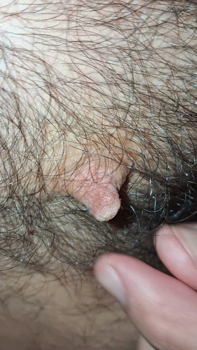 Hairy nipples in the foreground