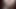 3D قرنية تأثيري ناضجة جبهة مورو الإسلامية للتحرير لديها أول مرة لها الجنس الثلاثي
