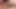 Myhard2inch micropenis vrs AAA BATRY