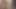 Lizzy Yum 2023 JUST masturbation #2 post op orgasm pussy masturbation