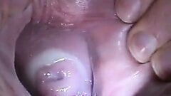 Insertion de sperme dans le spéculum de la chatte du col de l'utérus