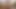 Lizzy Yum July 2023 just My Clit #2 Post Op orgasm pussy clit masturbation teasing orgasm