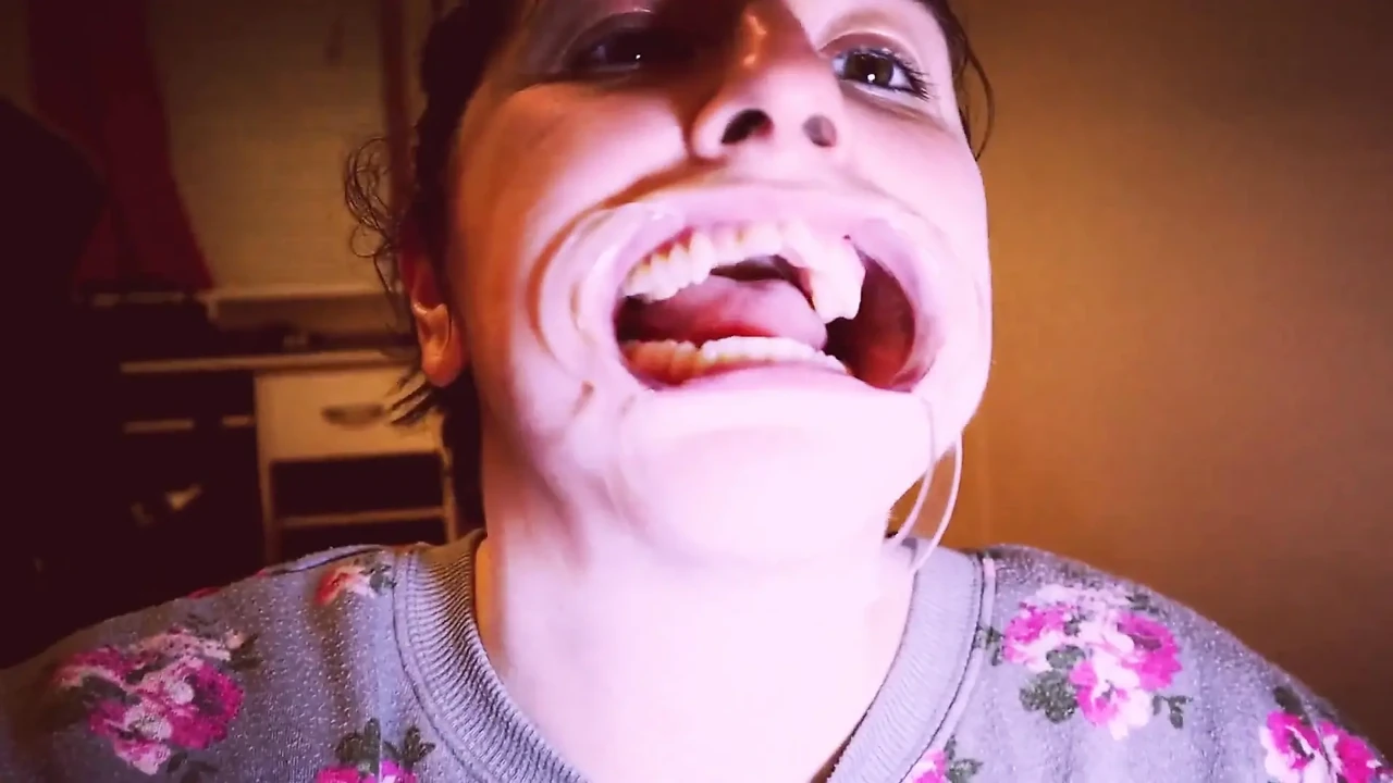 Preparing for Invisible Aligners