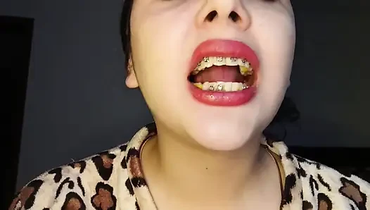 Chew Cheetos Bakış Açısı