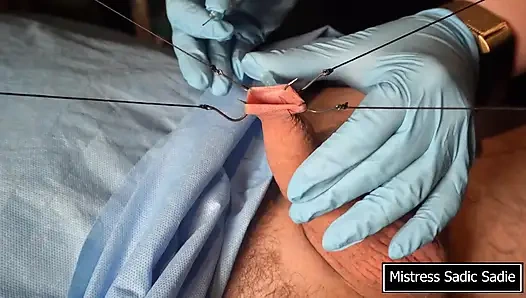 Иглы — КПТ в лучшем её проявлении!