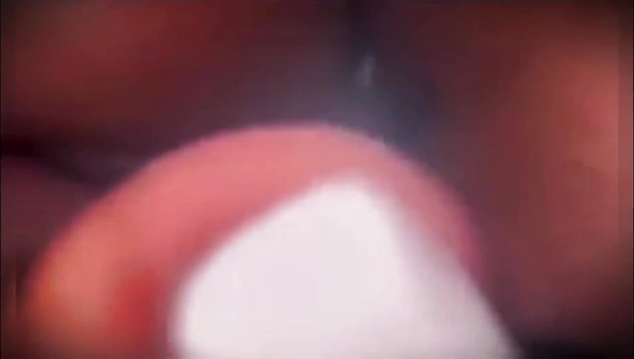 Deep Anal Penetration: Too Much for Me