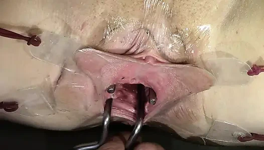 Vagina Yang Tersebar Luas Bahkan Lebih Jauh Membuka Sperrs Dan Dengan Dildo Mengedit Dari Dekat, Melihat Ke Dalam Dan Menyemprotkan