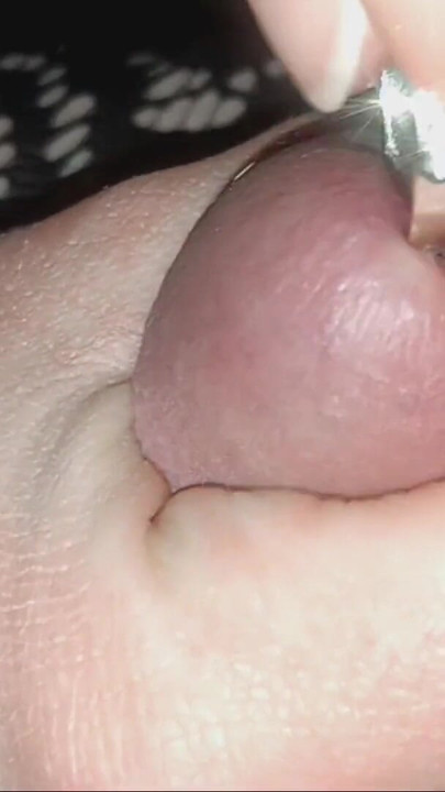 Hubby gets the works but not relief | Clip 1