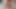 ForeSkinMafia By Boomer Banks
