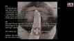 Video pregled