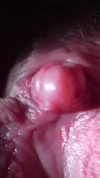 Επική στιγμή από το "ENLARGEGING THE CLITORIS BY PUMPING"