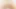 Zakoman Training Diary 40, Chestnut Suction & Wart Vibrator Training ~ Twitching Anal ~