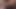 Tugging on my penis - July 2025 - Foreskin restoration