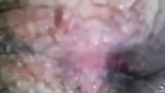 hairy used asshole show