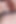 継母の母乳を飲ませて脱水症状にならないようにする