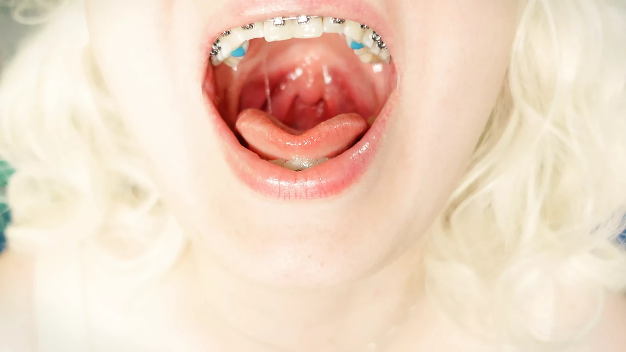 BRACES fetish - ASMR video of eating MUKBANG... food fetish.