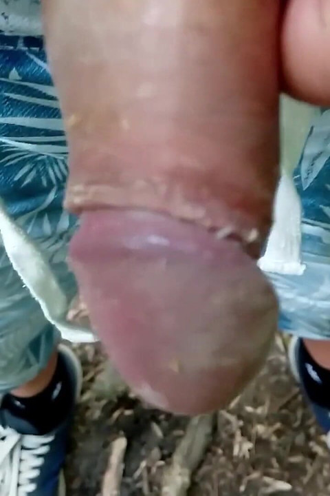Keju di bawah kulup kontol kotor di luar ruangan berjalan muncrat bocor dan orgasme mani muncrat bagian 2