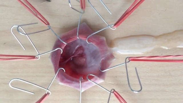 Cbt