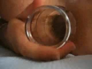 Anus et verine