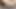 Deep Anal Masturbation Big Gaping Hot Anal Prolapse