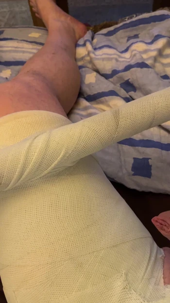 Hipspica cast