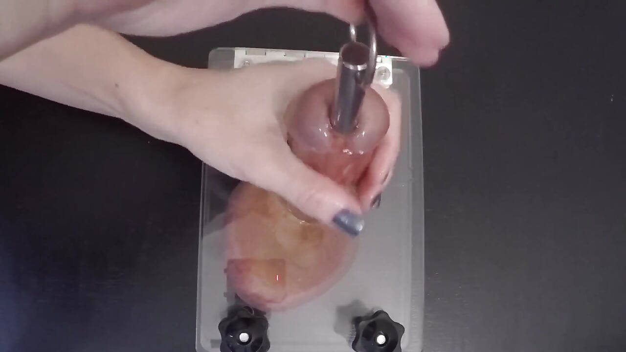 Compilation of Extreme but Effective Sperm Extraction Methods