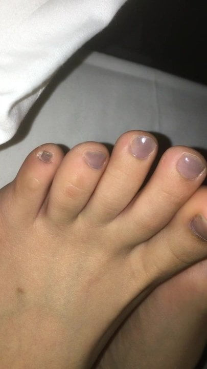 Toes