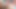 Aliya Brynn’s tiny body is put to the ultimate test