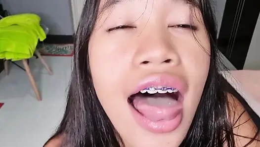 Kehamilan gfe tanpa rencana