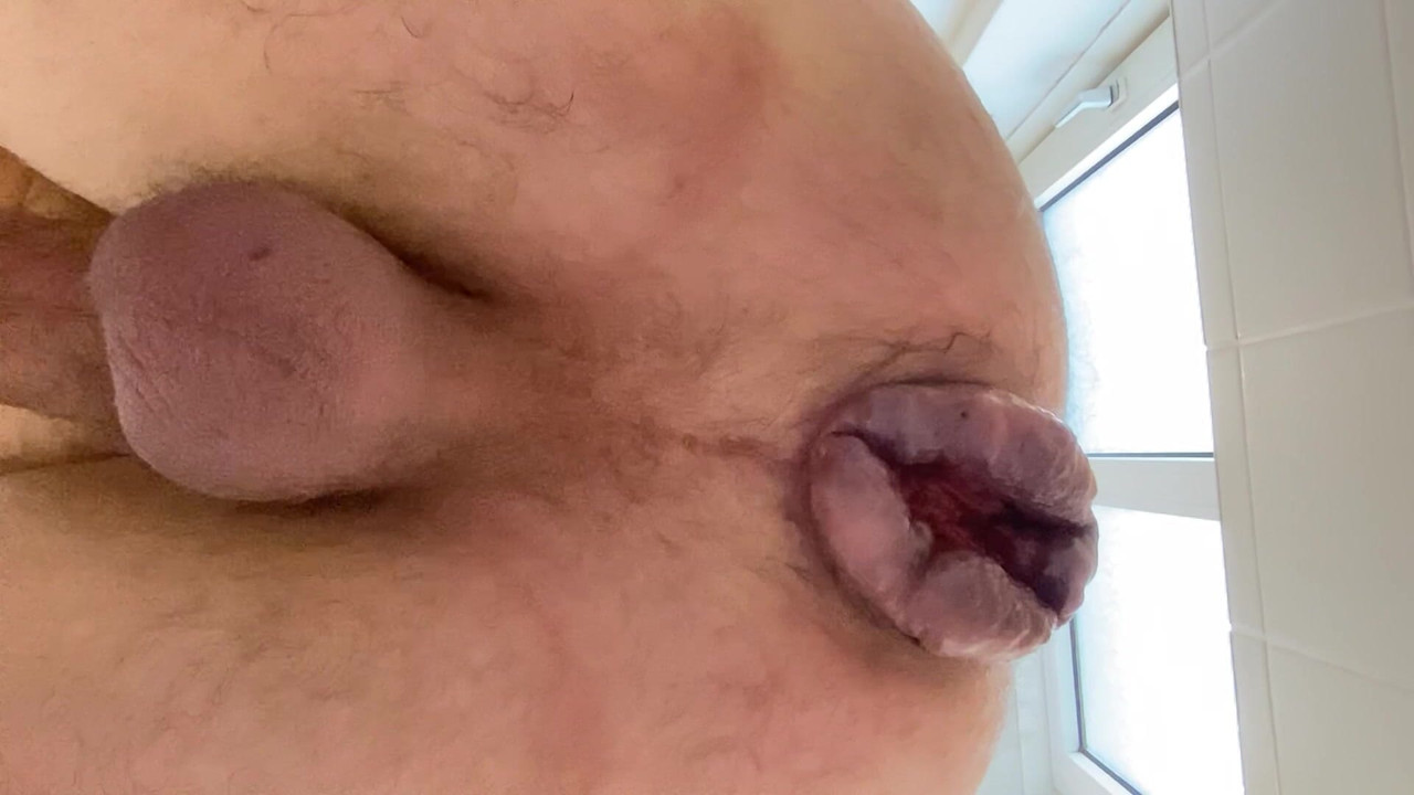 Great Anal Gape And Huge Rose!