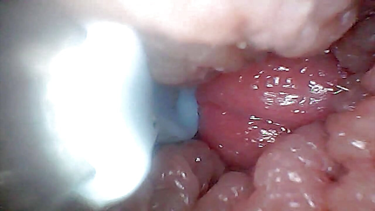 Guia Visual para Estimulação e Endoscopia de Ponto G