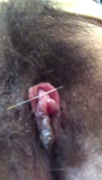 Clitoris needle piercing