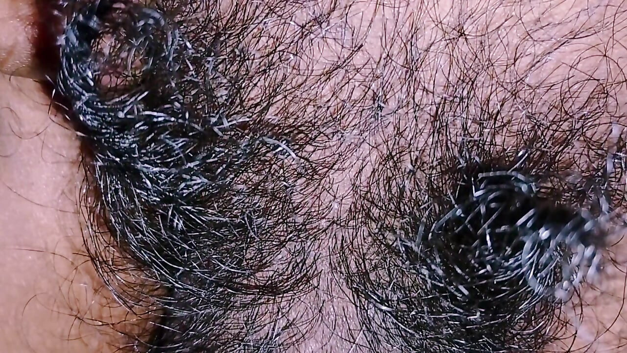 Long hair of penis