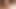 A young teenager with bandaged balls and a swollen penis Broke into my house and put his ass under my hard fuck with a big dick