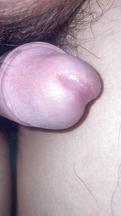 Massage the prostate and urethral bulb fluid.
