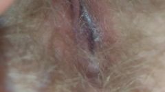 Resting Mother in law hairy holes