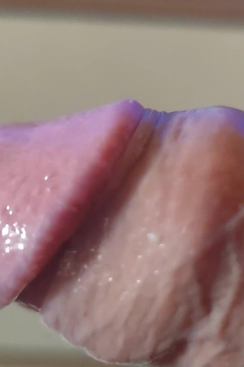 Strange Lumpy Cock with a Gigantic Head.