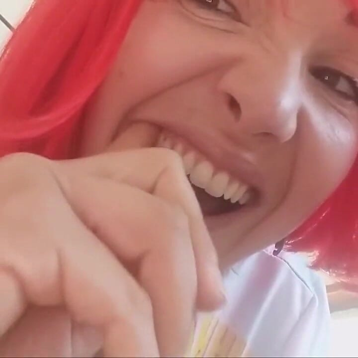 Chantals zähne fallen auseinander, rotten und schwarz