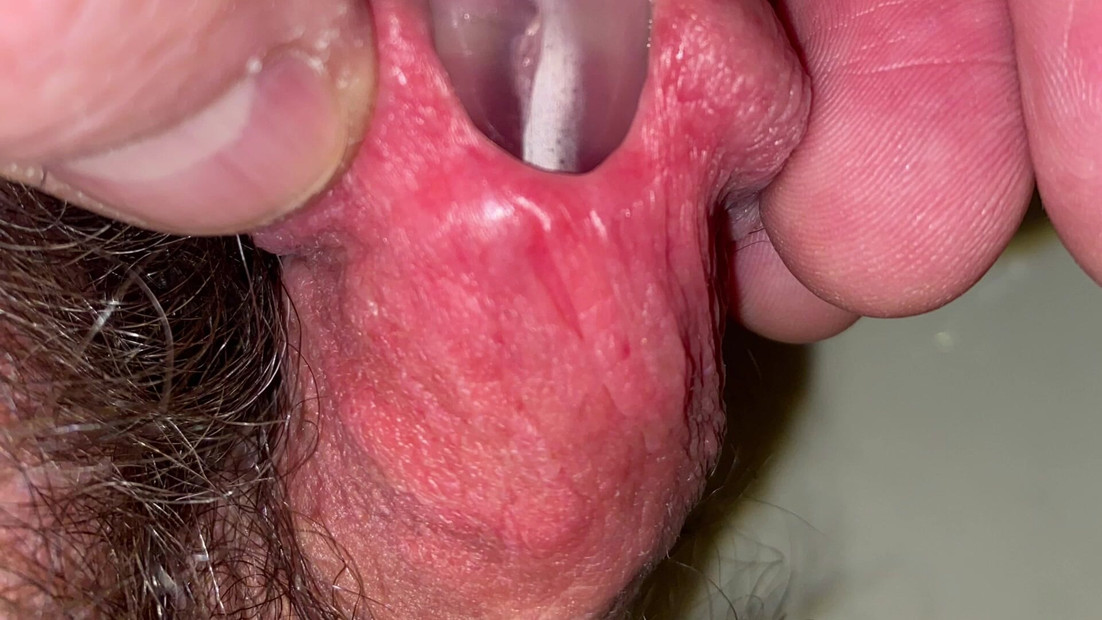 Âm thanh một ống tiêm mà không có một đầu sâu bên trong