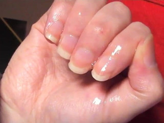 80 - Olivier fingers sucking and nails biting (01 2018)