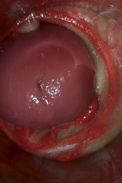 Kamera Unutar Duboke Pičke Snima Ogromnu Ejakulaciju Sperme Asmr
